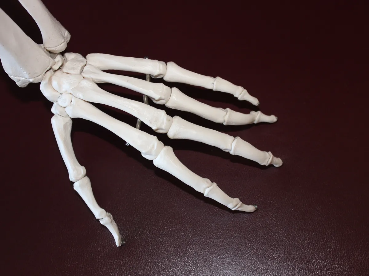 Managing Arthritis: Physiotherapy Tips to Improve Quality of Life